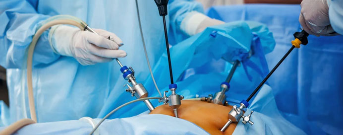 Laparoscopic Surgery