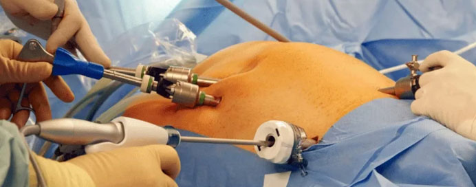 Onco Surgery
