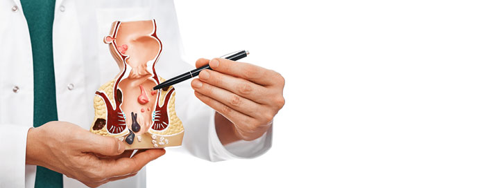 Laser Surgery for Anorectal Diseases